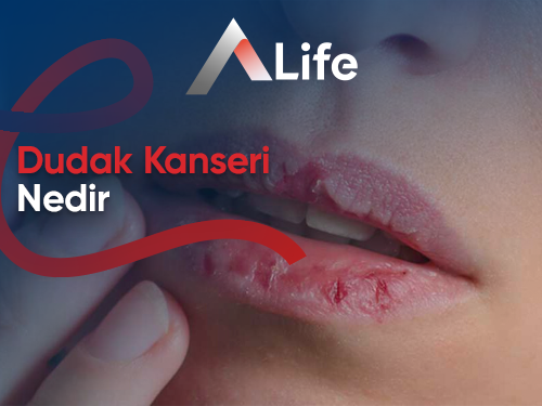 Dudak Kanseri Nedir ?